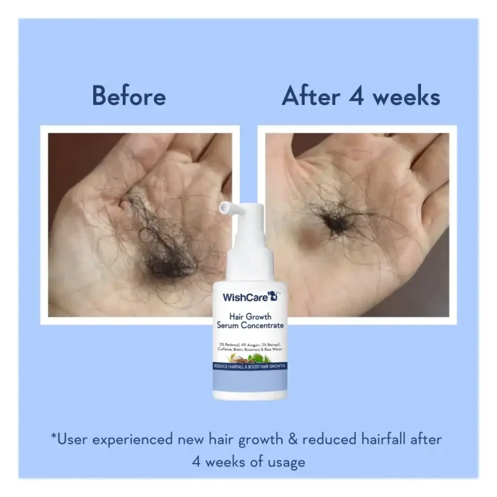 WishCare Hair Growth Serum Concentrate - Rosemary, 3% Redensyl, 4% Anagain, 2% Baicapil, Caffeine, Biotin, Plant Keratin & Rice Water – 50ml - Image 2
