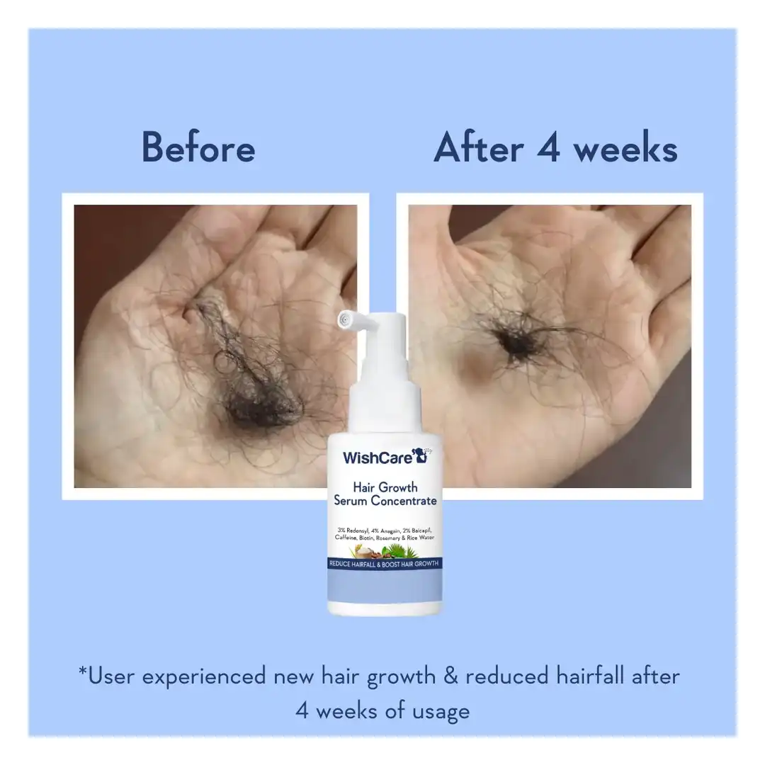 wishcare hair regrowth4 WishCare Hair Growth Serum Concentrate - Rosemary, 3% Redensyl, 4% Anagain, 2% Baicapil, Caffeine, Biotin, Plant Keratin & Rice Water – 50ml - Image 2